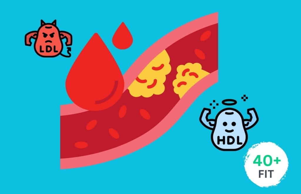 what is Hypercholesterolemia